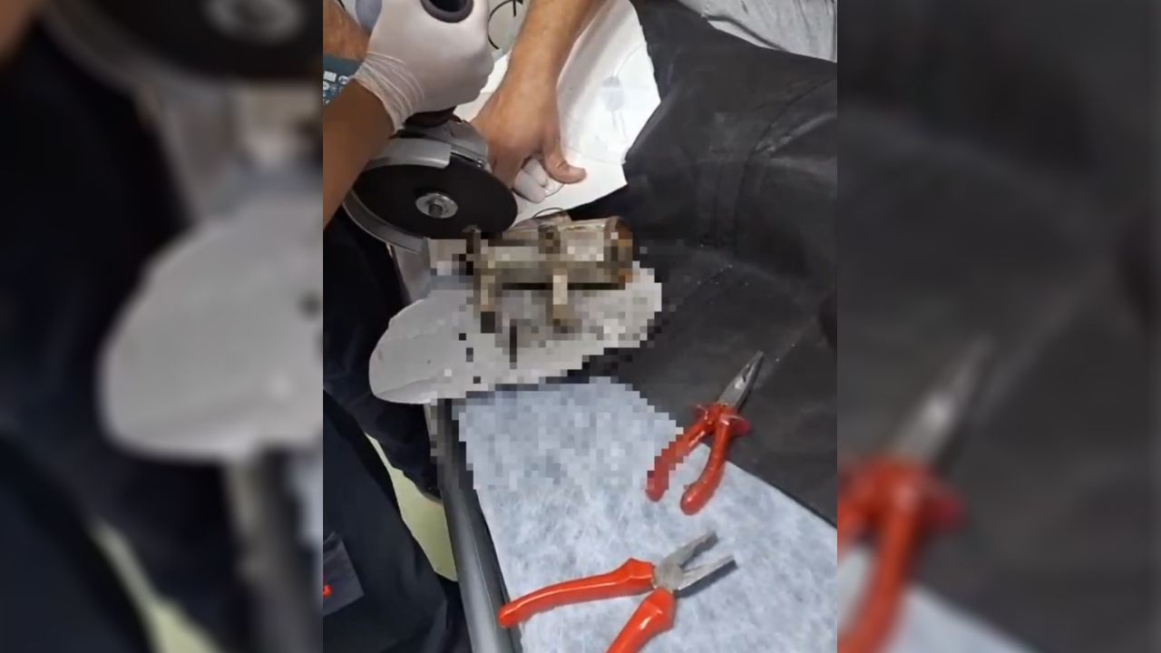 Şanlıurfa’da küçük Sara’nın eli kıyma makinesinden kurtarıldı
