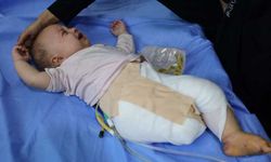 Minik Hani'nin ayağı siyonist bombalarla koparıldı, gülüşü de susturuldu