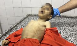 Açlık Gazze'de çocukları vurmaya devam ediyor: 3 günde 21 çocuk şehit oldu