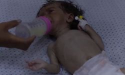 UNICEF: Haziranda Gazze'de 5 bin 800’den fazla çocuk yetersiz beslenme yaşadı