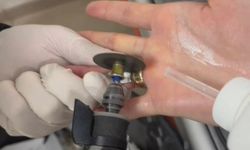 Parmağına sıkışan yüzük itfaiye ekiplerince çıkarıldı