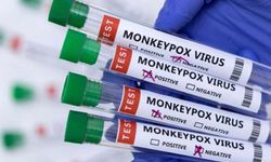 Afrika kıtasındaki mpox acil durum statüsü kaldırıldı