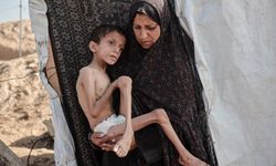 BM: Gazze'de akut yetersiz beslenme vakaları 95 bine dayandı