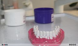 Diş beyazlatmada doğru bilinen yanlışlara dikkat