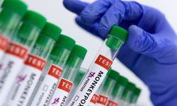 Madagaskar'da M Çiçeği vaka sayısında artış 