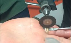 Batman'da parmağa sıkışan yüzüğe itfaiye müdahalesi