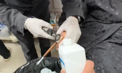 Batman'da kadının parmağına sıkışan yüzük çıkarıldı