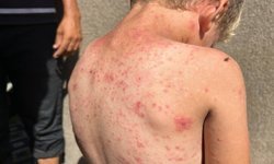 BM'den Gazze'de sağlık uyarısı