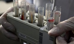 DSÖ'den 'küresel hepatit' uyarısı