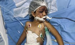 Dünya Sağlık Günü'nde Gazze'deki sağlık durumu hakkında çarpıcı rakamlar