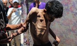 Gazze'de "Salgın hastalık" uyarısı