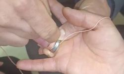 İtfaiye ekipleri parmağa sıkışan yüzüğü çıkardı