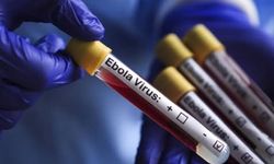 Belçikada Ebolaya karşı önlemler artırılıyor