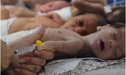 Kötü beslenme Gazze'de binlerce çocuğun hayatını tehdit ediyor