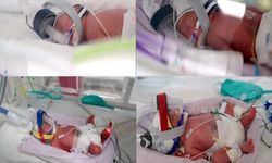 Avustralya'da tek yumurta dördüzleri dünyaya geldi