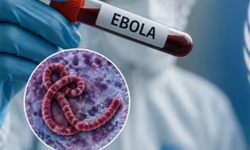 Kongo'da Ebola salgını: Ölü sayısı 1000'i aştı