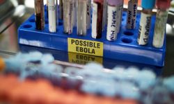 Kongo'daki Ebola salgınında ölü sayısı bin 500'ü aştı