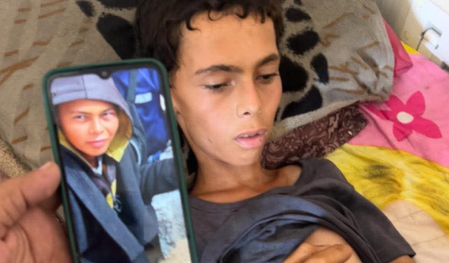 Gazze'de kıtlık nedeniyle bir çocuk daha hayatını kaybetti
