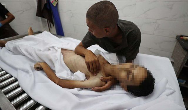 Siyonist rejimin Gazze'de on yıllardır süren "gıda silahı" politikası