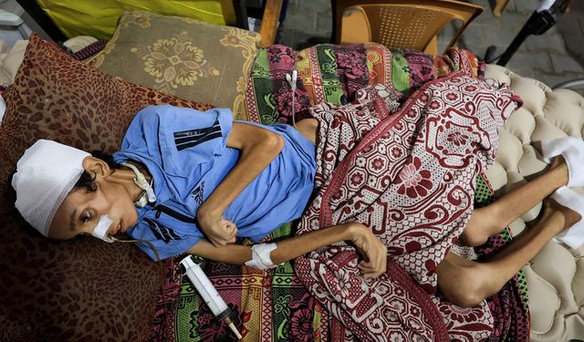 Gazze açlıktan ölüyor: 9 kişi daha açlıktan hayatını kaybetti