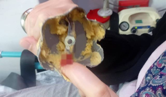 Batman’da parmağı blendere sıkışan vatandaşa acil müdahale