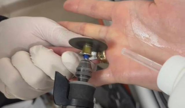 Parmağına sıkışan yüzük itfaiye ekiplerince çıkarıldı