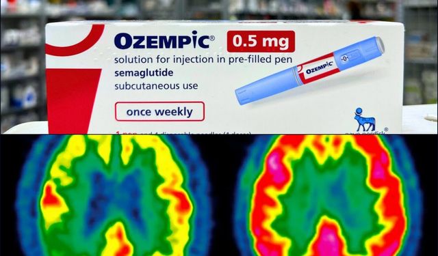 ABD’de GLP-1 ilaçlarıyla ilgili görme kaybı iddiaları mahkemeye taşındı
