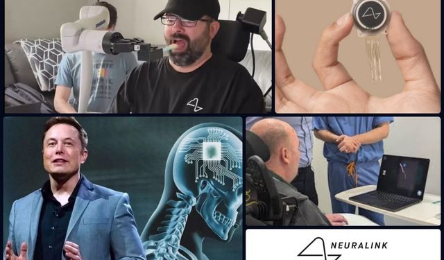 Beyin çipi sınırları aşıyor: Neuralink hastaları düşünce gücüyle robotik kol kontrolüne başladı