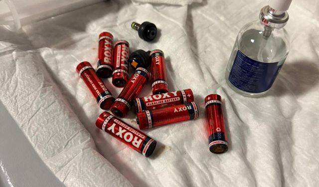 Bir kişi yuttuğu 9 kalem pil endoskopiyle çıkarıldı