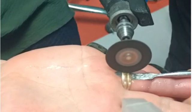 Batman'da parmağa sıkışan yüzüğe itfaiye müdahalesi