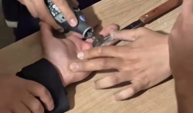 Parmağına sıkışan yüzük itfaiye ekiplerince çıkarıldı