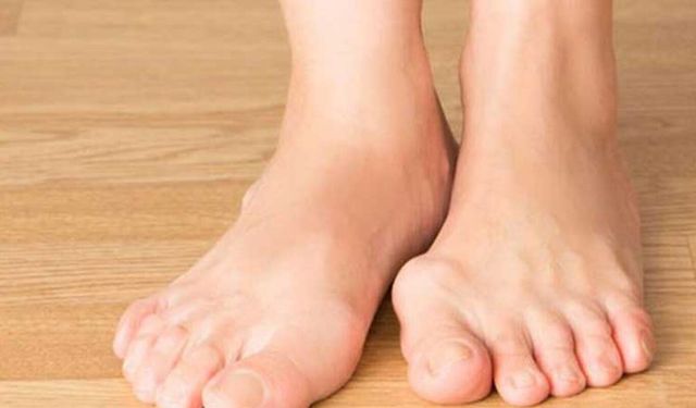 Halluks valgus yaşam kalitesini önemli ölçüde etkileyebilir