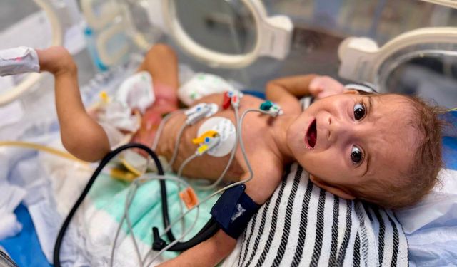 MSF: israilin kısıtlamaları nedeniyle Gazze'de hastaneler çalışamaz halde