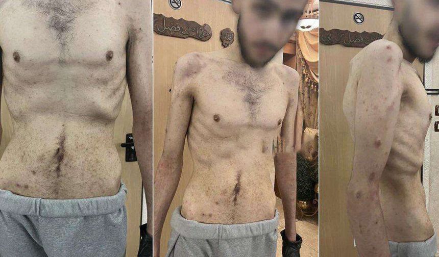 Haaretz'den çarpıcı itiraf: israil hapishaneleri işkence merkezine dönüştü